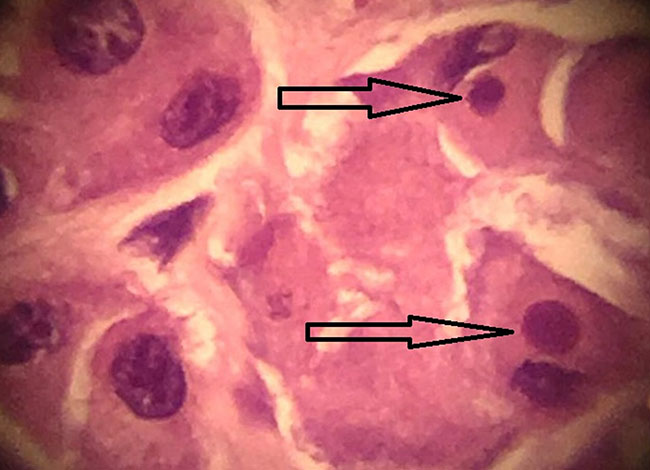Imatge del microscopi òptic on s’assenyalen amb fletxes unes estructures víriques. Autor: CRARC